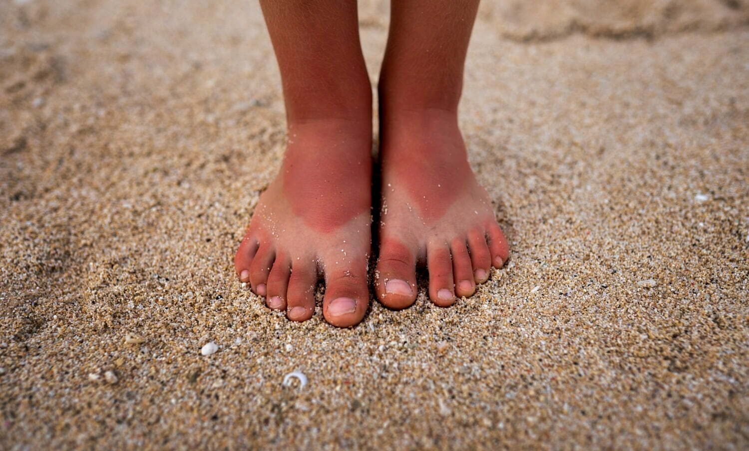 pies de niña sobre la arena insolación
