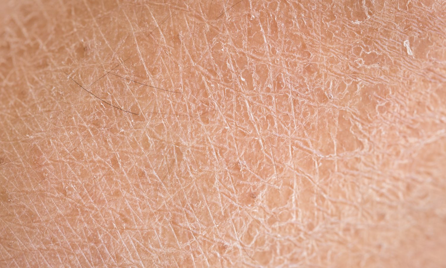 foto detallada de piel con resequedad