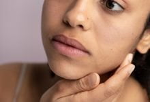 exceso de grasa en tu rostro ácaros / Enfermedades cutáneas que afectan el rostro - piel bonita