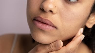 exceso de grasa en tu rostro ácaros / Enfermedades cutáneas que afectan el rostro - piel bonita