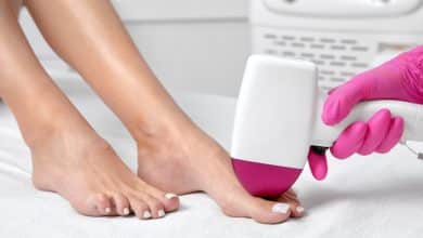 depilaci&oacute;n del vello en el cuerpo de la mujer / vello corporal en las mujeres