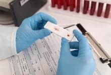 &iexcl;Preocupante! Aumentan los casos de VIH/Sida en esta ciudad del pa&iacute;s