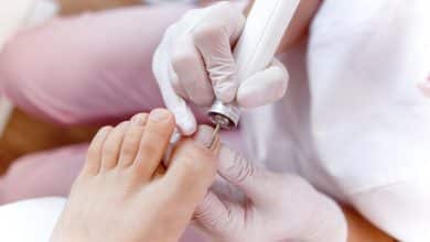 Los peligros de tener una u&ntilde;a enterrada