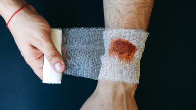 quemaduras de p&oacute;lvora