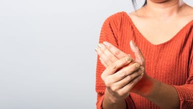 Remedios naturales para aliviar las quemaduras en la piel