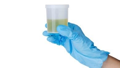 5 causas comunes de mal olor en la orina y c&oacute;mo solucionarlas