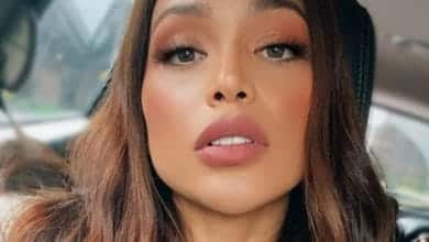 As&iacute; le qued&oacute; el rostro a Andrea Tovar, ex Se&ntilde;orita Colombia tras accidente que sufri&oacute;