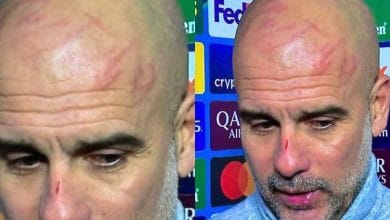 Guardiola aparece en p&uacute;blico lleno de ara&ntilde;azos