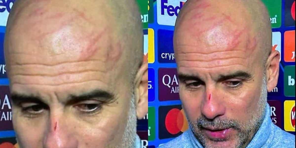 Guardiola aparece en p&uacute;blico lleno de ara&ntilde;azos