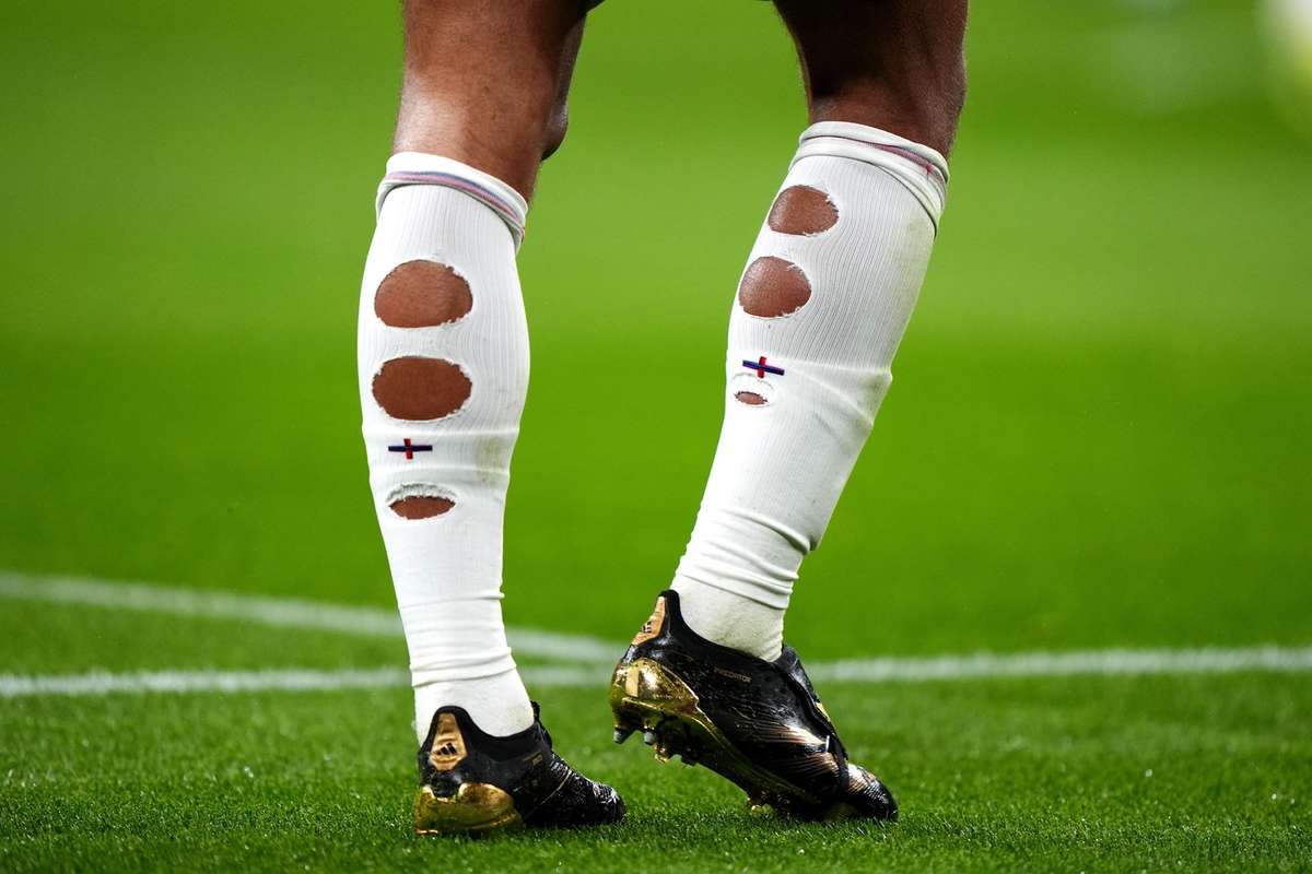 No es por moda: esta es la verdadera raz&oacute;n por la que los futbolistas rompen sus medias antes de jugar